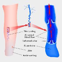 Pixwords Vaizdas su odos, kojų, kojų, kulkšnių, kraujo, rodyklės, medicinos, medicina Designua